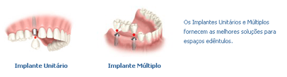 implante2